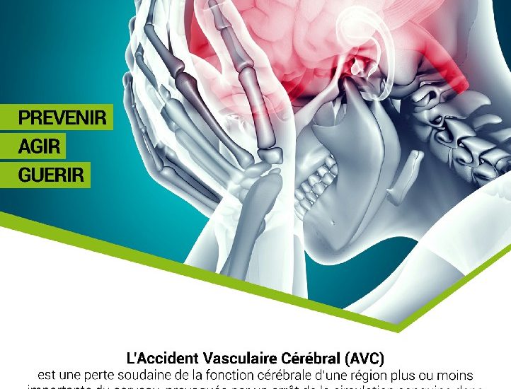 L’accident vasculaire cérébral (AVC) touche 150.000 Français chaque année. Pourtant, des milliers de cas annuels pourraient être évités, et ce grâce à des petits gestes simples à adopter au quotidien. Découvrez les bonnes habitudes à prendre pour prévenir l’AVC.